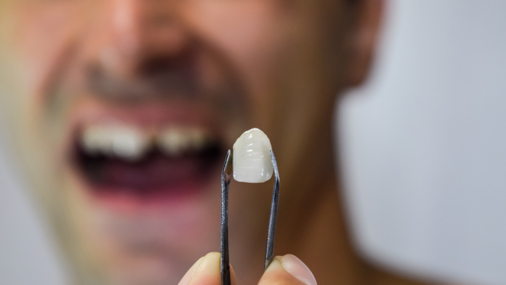 Χτύπημα στο Μπροστινό Δόντι