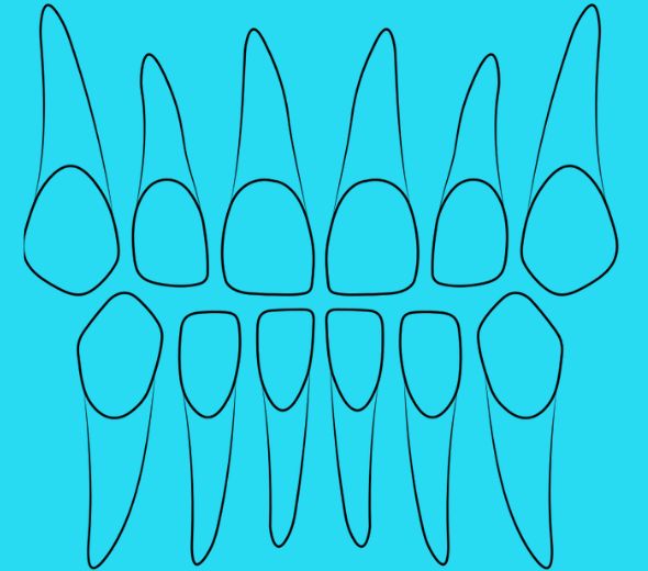 ΚΥΝΟΔΟΝΤΑΣ & ΚΟΠΤΗΡΑΣ