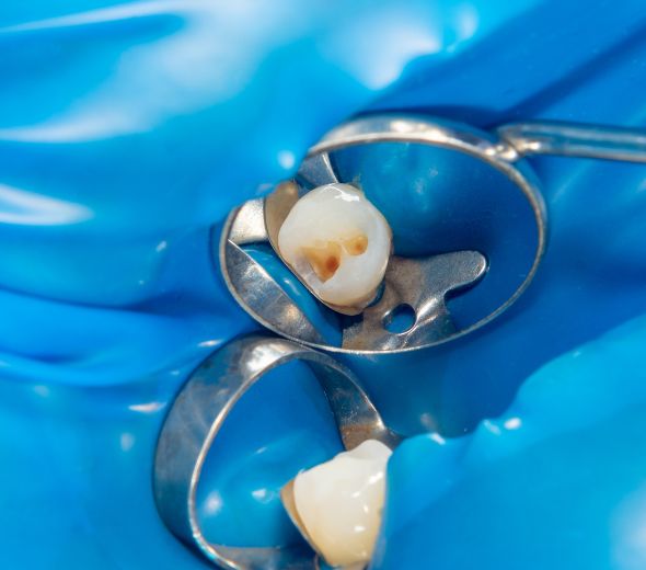 ΑΞΟΝΑΣ ΜΕ ΘΗΚΗ ΔΟΝΤΙΟΥ