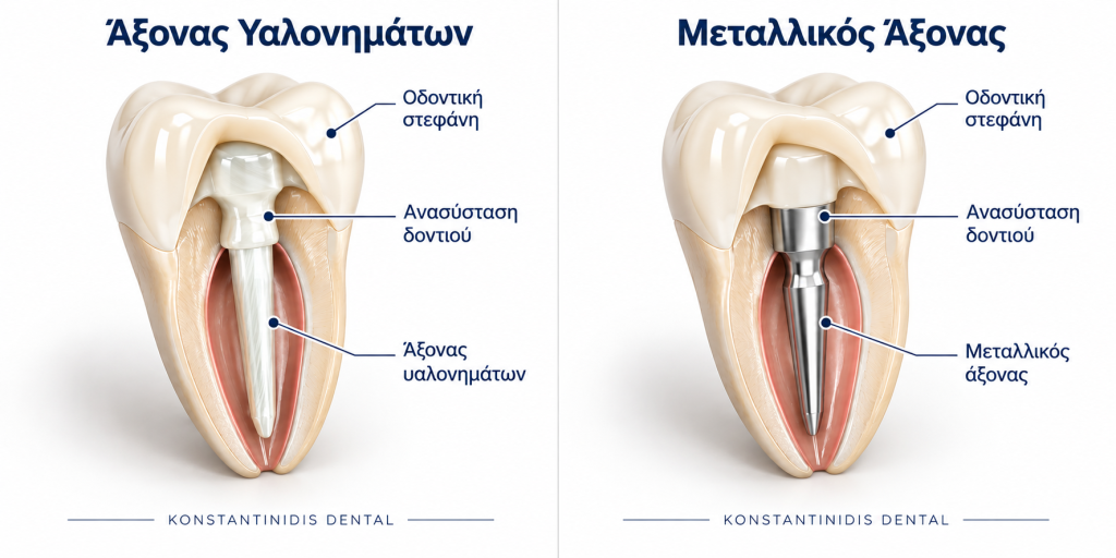 Άξονας υαλονημάτων για ανασύσταση δοντιού